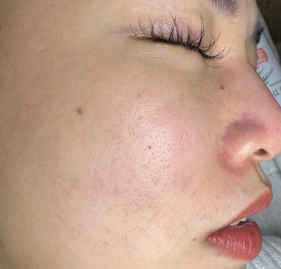 Dịch vụ chăm sóc da chuyên sâu