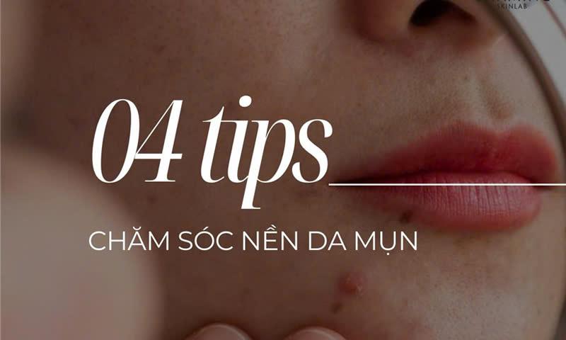 4 Tip chăm sóc da mụn hiệu quả