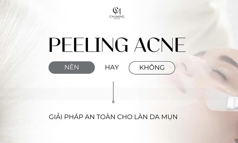 Peeling Acnes - Nên hay không